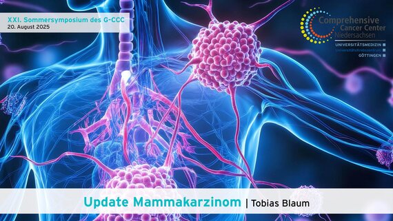 G-CCC-Sommersymposium 2025: Update Mammakarzinom